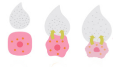 Hyper-osmolality : cells are dried out, shrunked